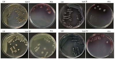 Pseudomonas aeruginosa mucinous phenotypes and algUmucABD operon mutant characteristics obtained from inpatients with bronchiectasis and their correlation with acute aggravation